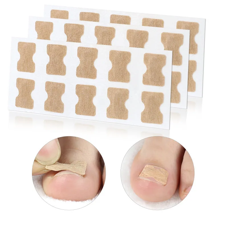20 piezas Corrector de uñas de los pies pegatina paroniquia tratamiento fijador recuperar Corrector pedicura pie herramienta para el cuidado de las uñas sin pegamento