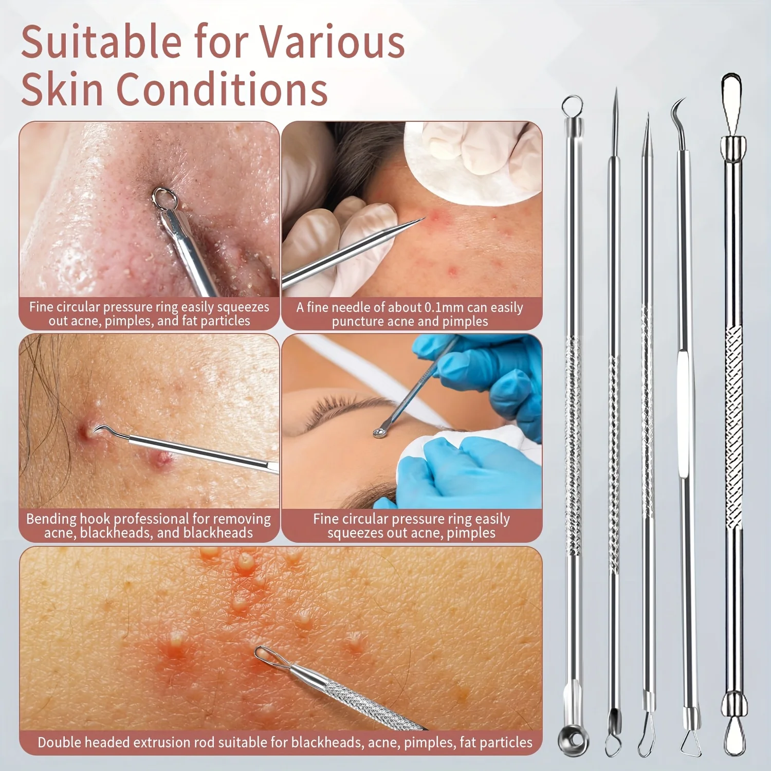 12個の黒ずみ除去ツール、ニキビ除去ツールキット、黒ずみを素早く簡単に除去、女性の顔の毛用の精密な眉毛ピンセット