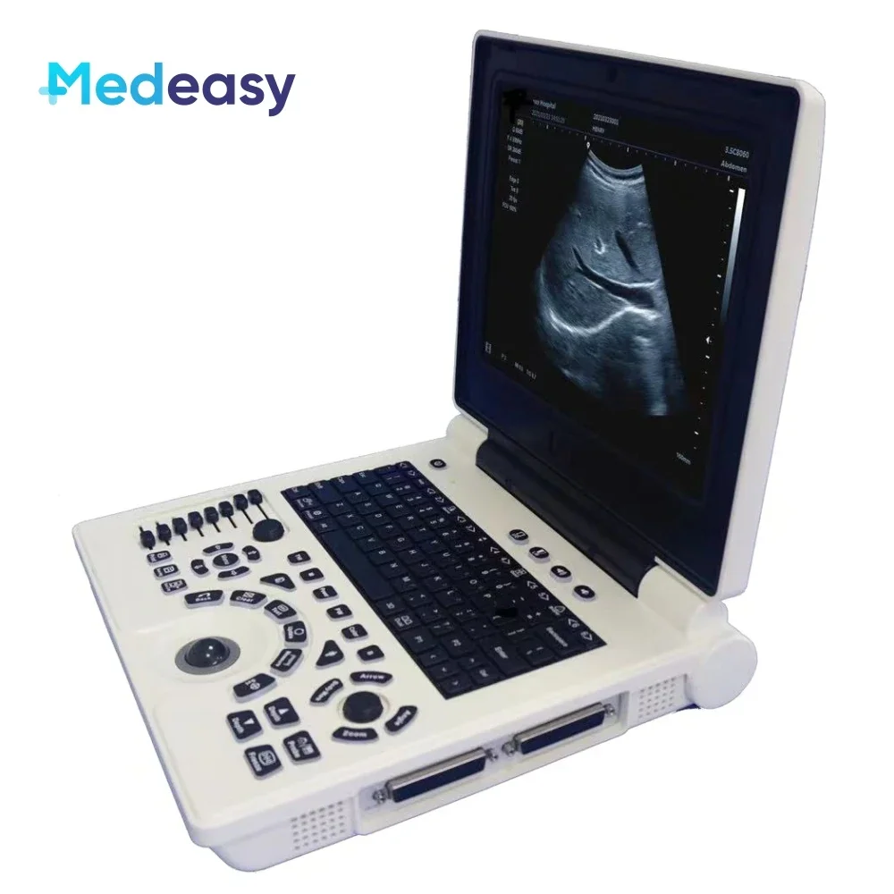 New Laptop B/W Ultrasound Scanner with PW/ IMT Function