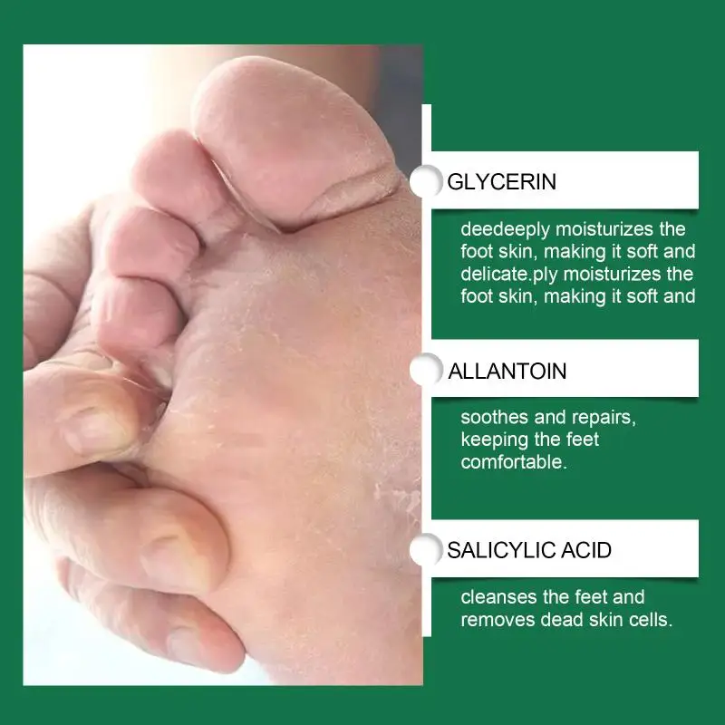 Foot Cuticle Remover 100ML Dead Skin  Exfoliator Gel Home Spa Pedicure Nail Softener For Smooth Feet view 3