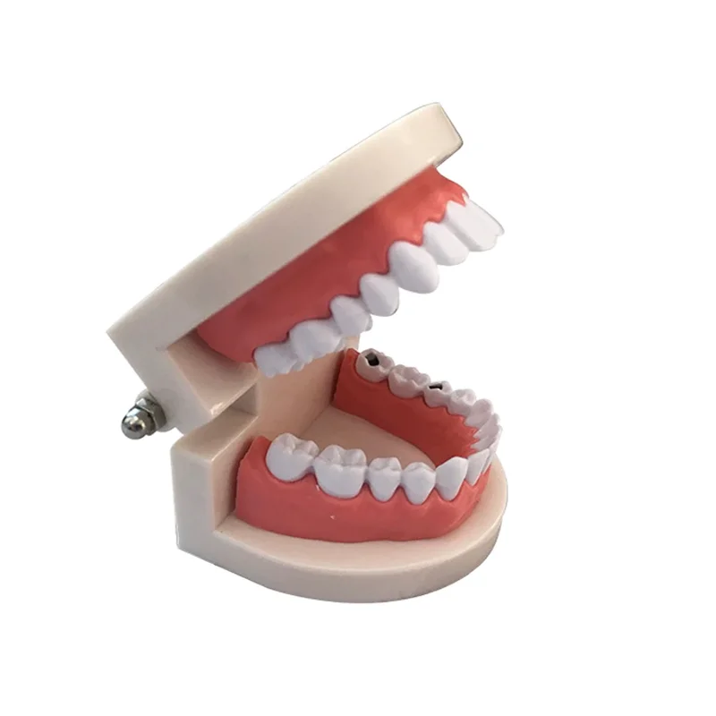 Dental Education Model With Caries Tooth Standard Teeth Model Dentist Teaching Study Typodont Brushing Teeth Demonstration Tools