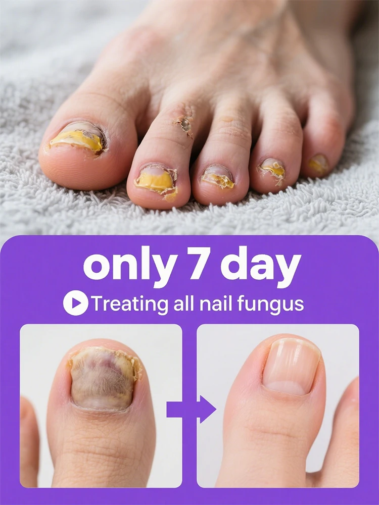 

Moisturizing your toes is easy