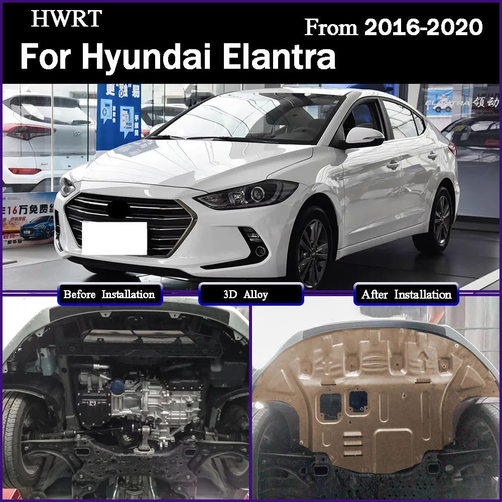 

Under Engine Guard Splash Shield Mud Fender Cover Plate Fender Mudguard Protector Alloy For Hyundai Elantra 2016-2020 1.5L 1.4T