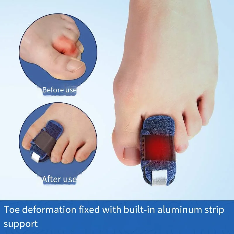 

1PC Feet Care Toe Splint Straightener Fingers Claw Stabilizer Support Bent Claw Toe Corrector Alignment Protector