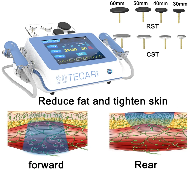 448KHZ Tecar Therapy RET CET permeabile al calore per alleviare il dolore del corpo tenuta della pelle terapia per la rimozione della cellulite Indiba permeabile al calore