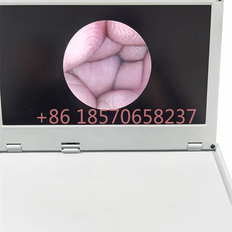 Medical integrated camera 1080P HD endoscopy integrated sinuscope camera