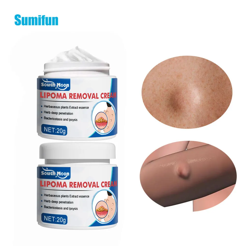 

1Pc Lipoma Removal Ointment Anti-Tumor Peeling Pain Relief Cream Fat Lump Remover Nodular Detox Chinese Medicine