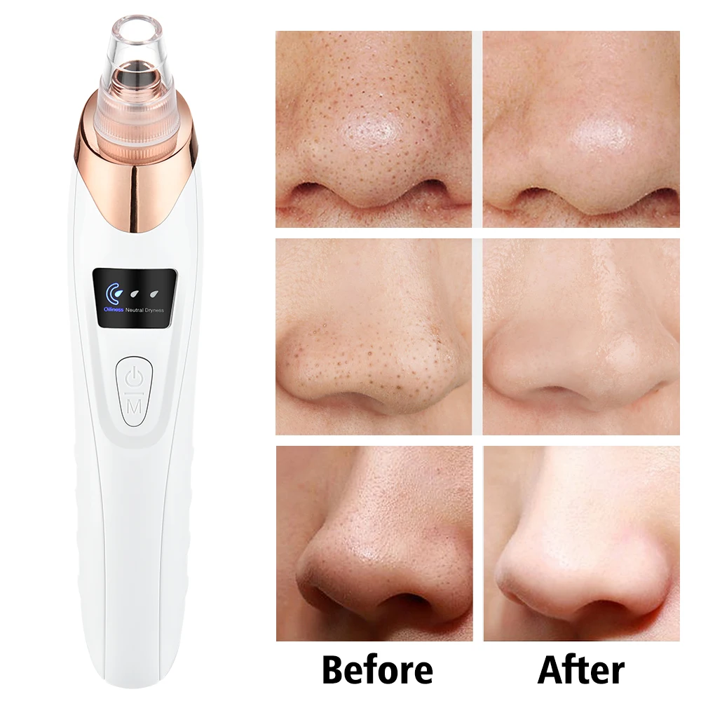 Verbeterde Comedondrukker Vacuüm Elektrische Poriereiniger voor Gezicht Neus Acne Extractor Tool met Krachtige Zuigkracht Gezichtsreiniging