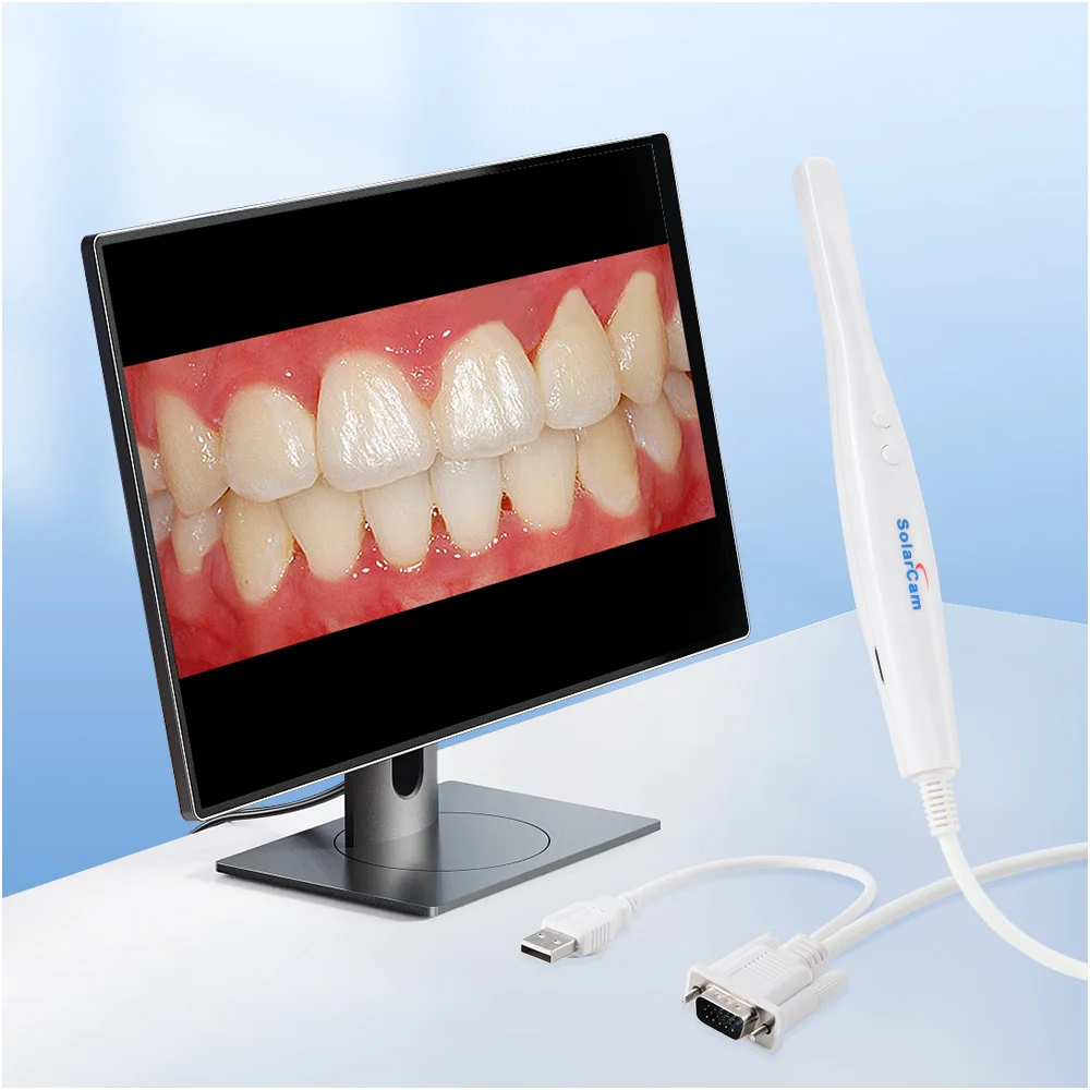 AZDENT Dental Digital Oral Endoscope Intraoral Camera With 8 White Cold LED Light VGA Type High Resolution for Oral Inspection