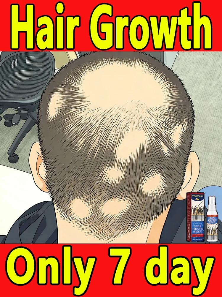 Este suero para la caída del cabello nutre rápidamente el cabello y previene eficazmente la caída del cabello. Adecuado para adultos y niños.