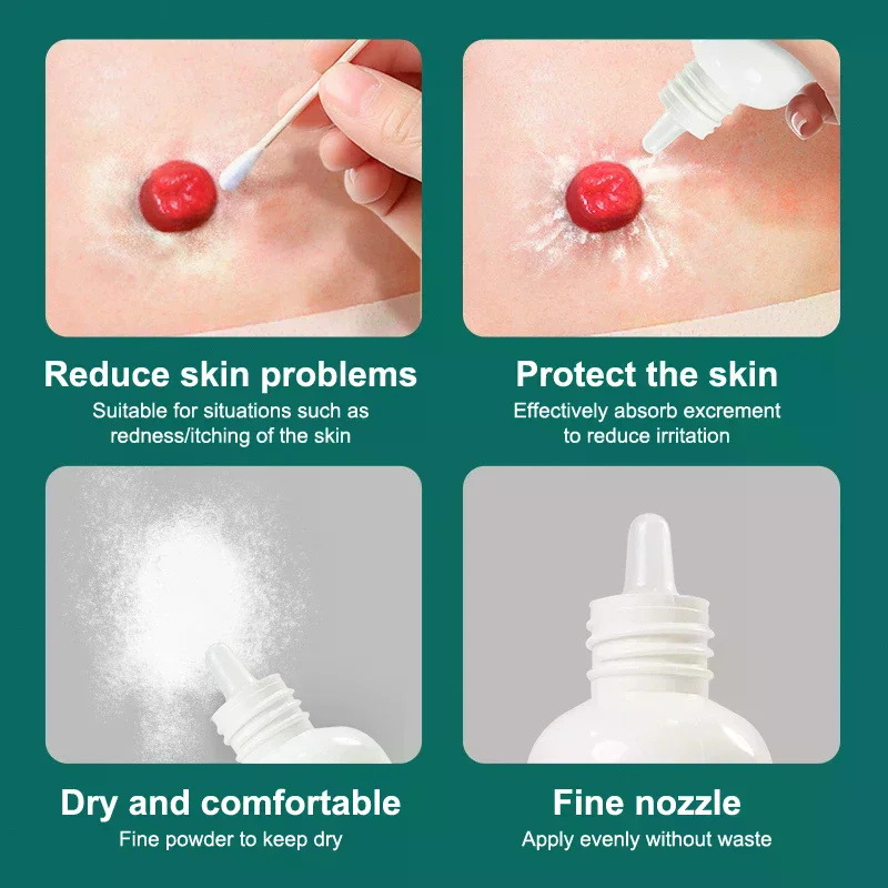 25g Skin Care Flour Dry Flour Stoma Treatment Medical For Tool Ostomy Accessory Colostomy Bag Supply Protective Care Products