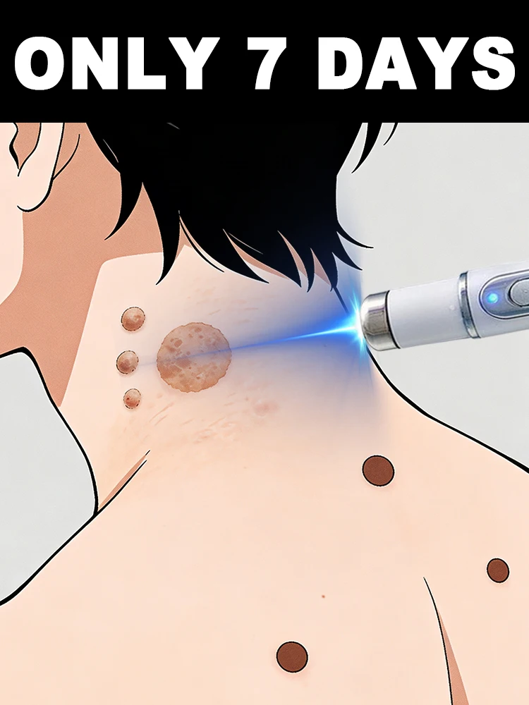 

Боль и страха шрамов делают удаление бородавок сложная и проблемная технология процесса HerrAN