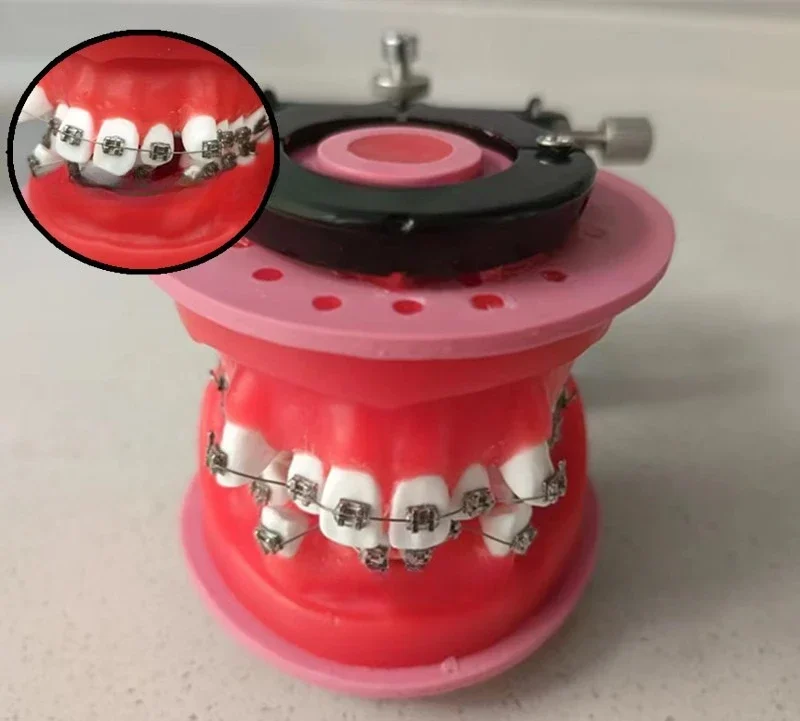 Orthodontic Practice Model Gingival Wax Dike Arch Wire Bending Oral Model Orthodontic Model Dental