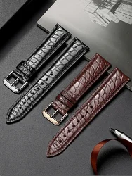 Genuine Leather American Crocodile Skin Watch Strap Men Women Butterfly Clasp for Tissot Longines Omega Mido CK Watchbands