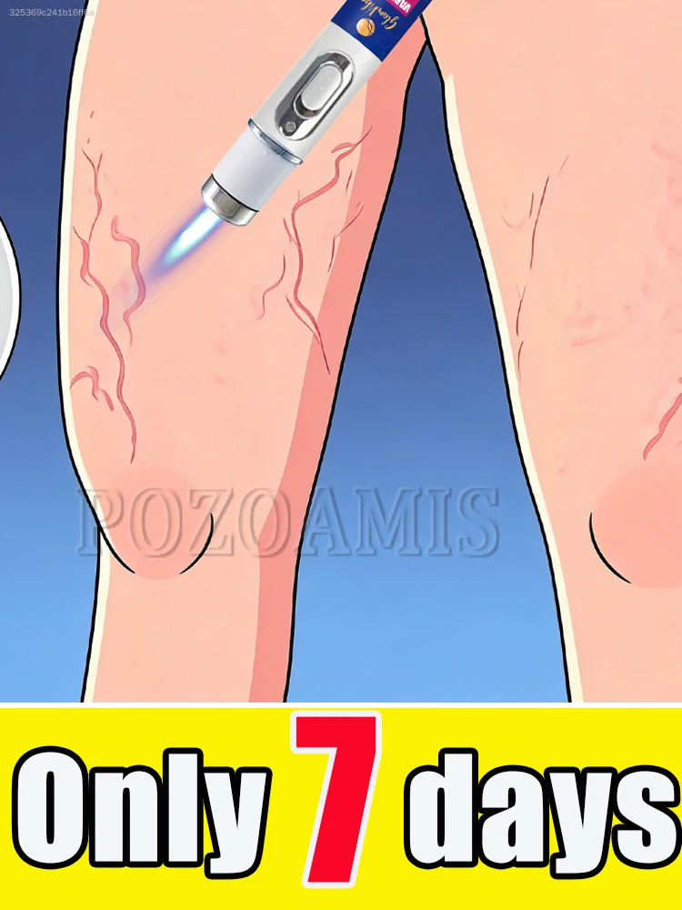 

Leg fatigue after sitting or standing for long periods of time