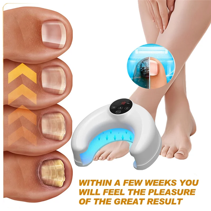 Grow Toe Nail Anti-Infections Paronychia Onychomycosis Wireless Nail Fungus Laser Device 14Pcs 470Nm Blue Light Toenails