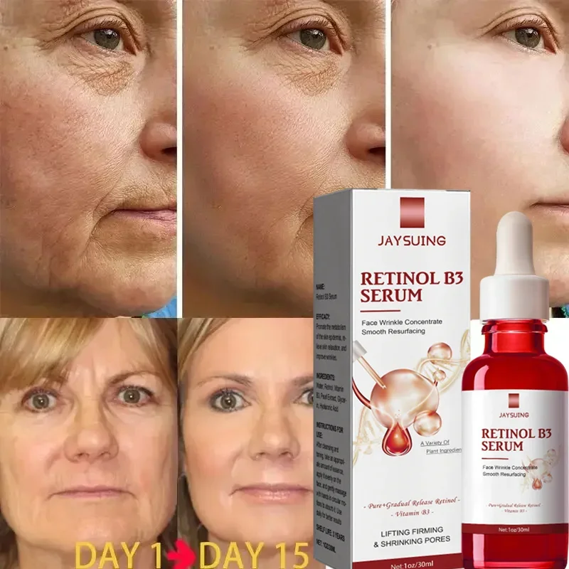 Retinol-Removedor de Rugas Soro Facial, Refirmamento Instantâneo, Lifting, Anti-Envelhecimento, Líquido, Fade Fine Lines, Clareamento, Produtos de Cuidados com a Pele Coreanos