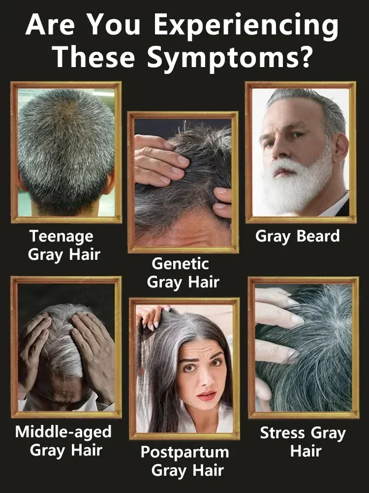 White hair killer, remove gray hair and restore natural hair color in 7 days