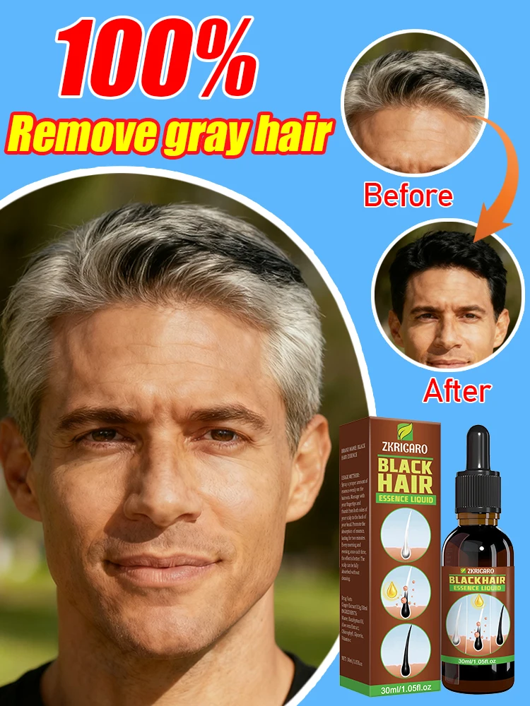 

Сыворотка для волос против седых волос, предотвращающая седые волосы, укрепляет пасту волос и восстанавливает фолликулы для волос.