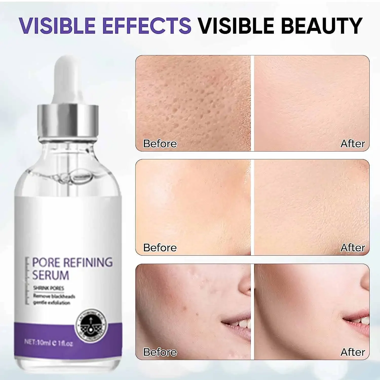 pore shrinking refining serum Facial Essence for cleaning minimizer Pore Moisturizing Oil Control Firming pore cleaner Skin Care