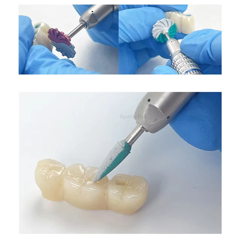 1 Stück Dental-Diamant-Polierscheibe mit 3 Körnungen, Gummi-Polierscheibe für Porzellan- und Zirkonoxid-Restaurationen, Zahnmedizin – Detail 5