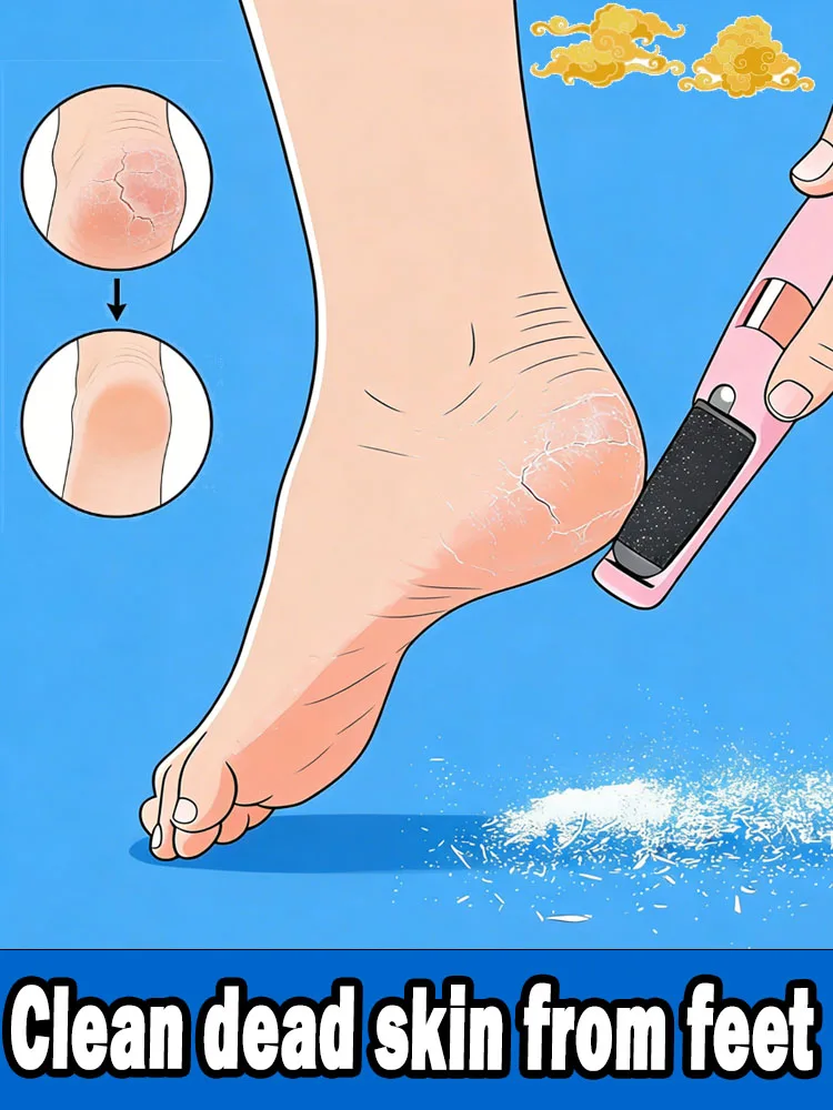 

new products electric file for heels heel exfoliation Help people remove dead skin