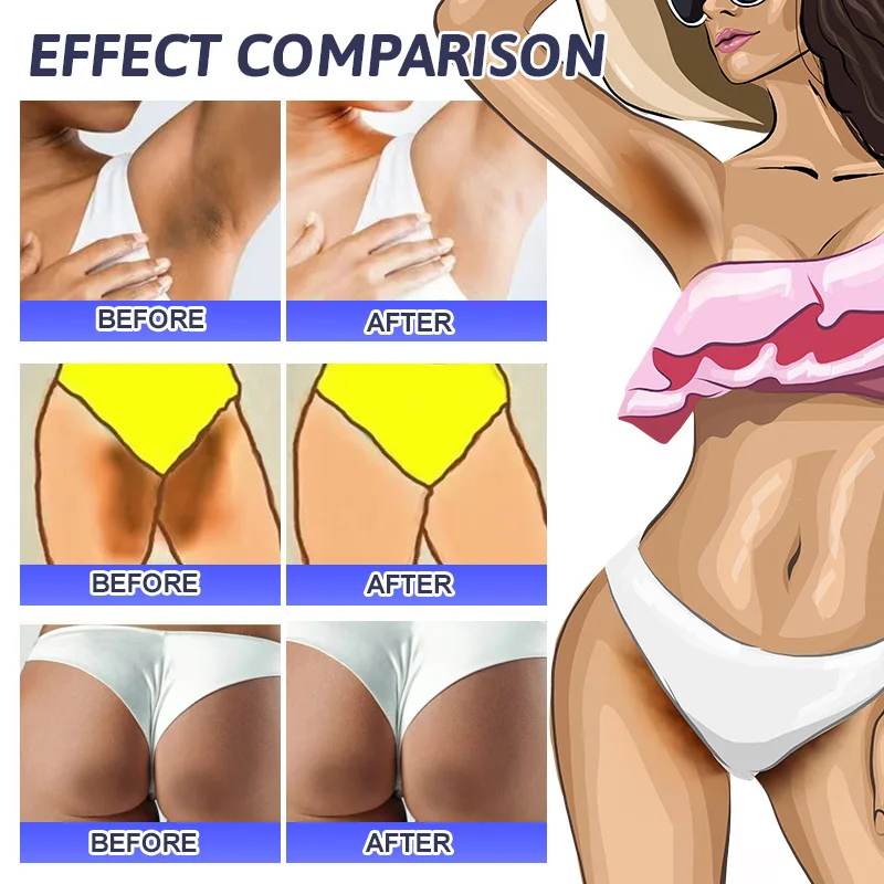 كريم تبييض الأجزاء الخاصة تحت الإبط مصل تبييض تبييض بعقب الركبة سطع الفخذ الداخلي الأجزاء الحميمة إزالة الميلانين الداكن