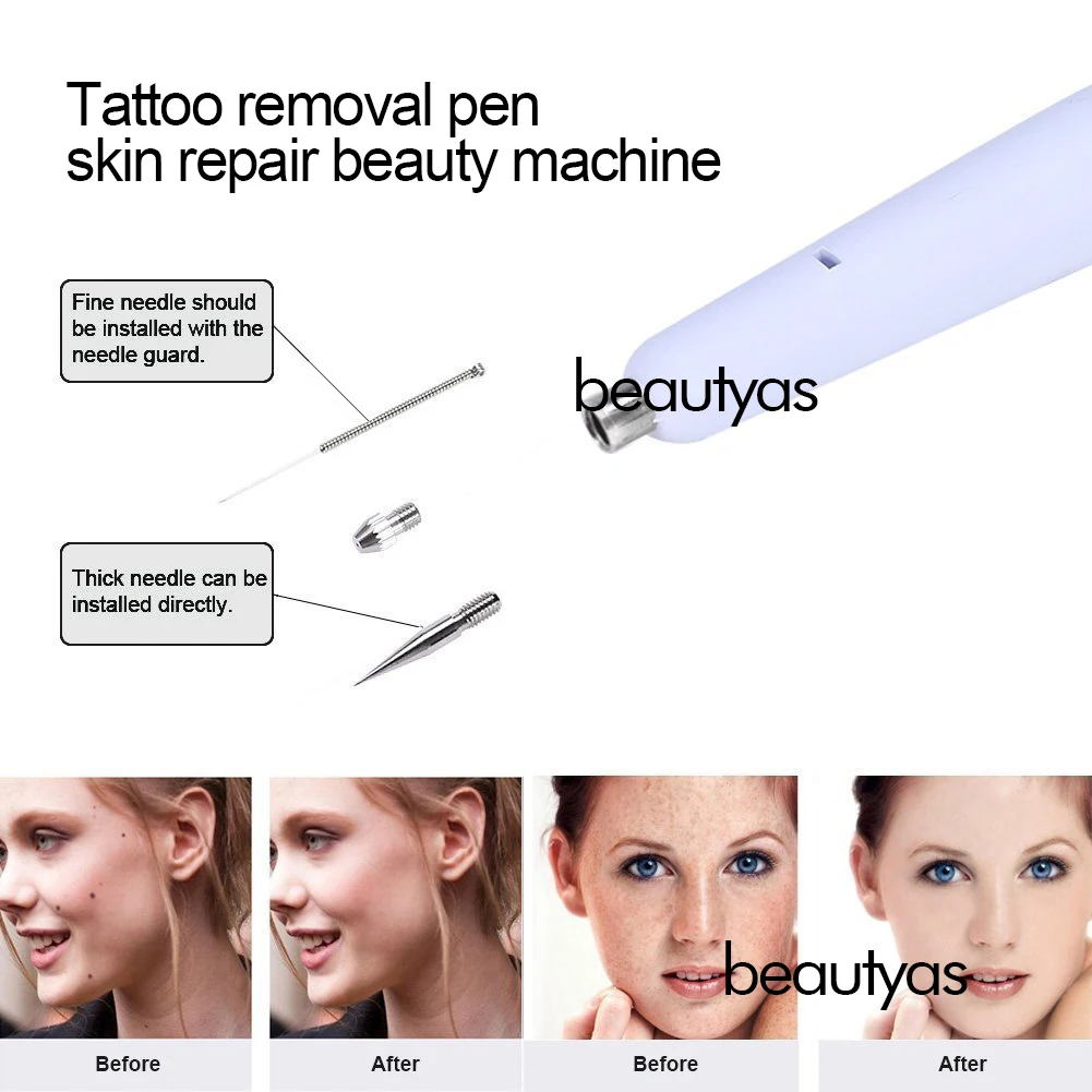 Stylo Plasma Professionnel pour Enlever les Verrues de la Peau, Cicatrice d'Acné, Taches de Rousseur, Étiquette Foncée, Nevus, lèvent, Taches, Tatouage, Machine de Soins