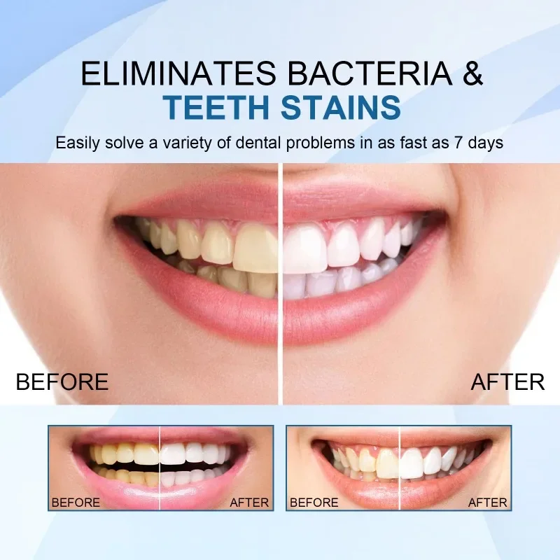 Teeth Essence Remove Plaque Stains Serum Fresh Breath toothpaste Oral Hygiene Against Dental Caries Dental Tooth Cleaning Tools