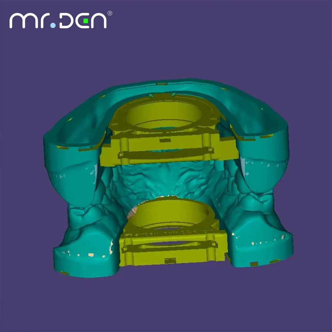 Digital Articulator Shim Universal for Average Value Articulators Semi-Adjustable and Fully Adjustable Articulators
