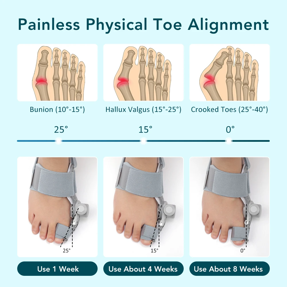 Bunion Adjuster Foot Hallux Valgus Braces Rotatable Toe Separator Straightener Adjustable Finger Toe Adjuster