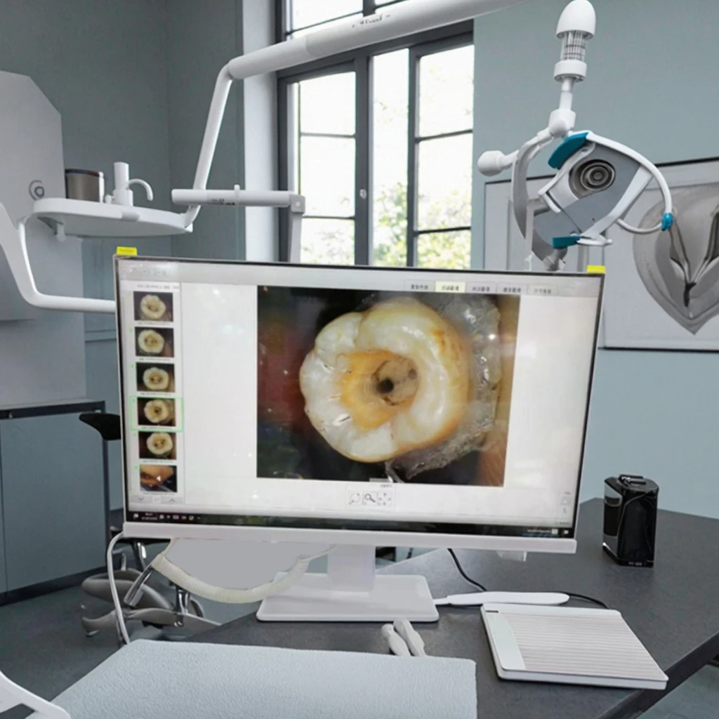 Portable Electric Dental Endoscope with Handle and Screen for Precise Easy Intraoral Examinations