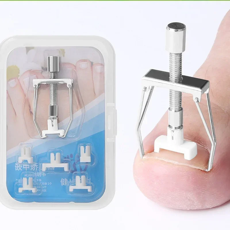 Herramienta de corrección de recuperación de uñas encarnadas, fijador de uñas de los pies, cuidado de uñas de los pies, Corrector de uñas ortopédico, herramienta de pedicura, nuevo