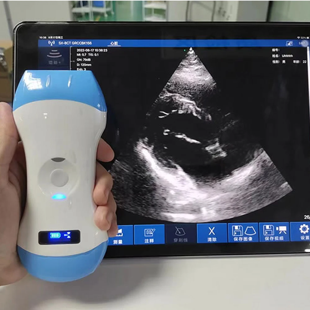 128E 3 in 1 Ultrasound Probe Wireless Color Doppler Convex Linear Phased Array Probe support iOS Android Windows