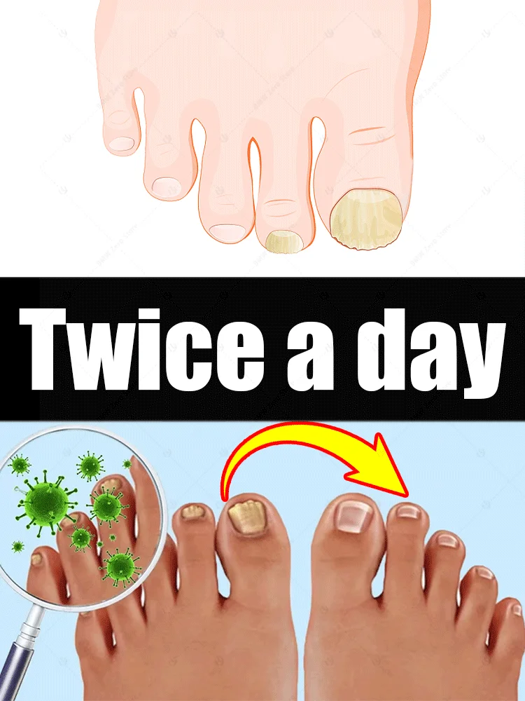 

manicure for bad Can in 7 days farewell