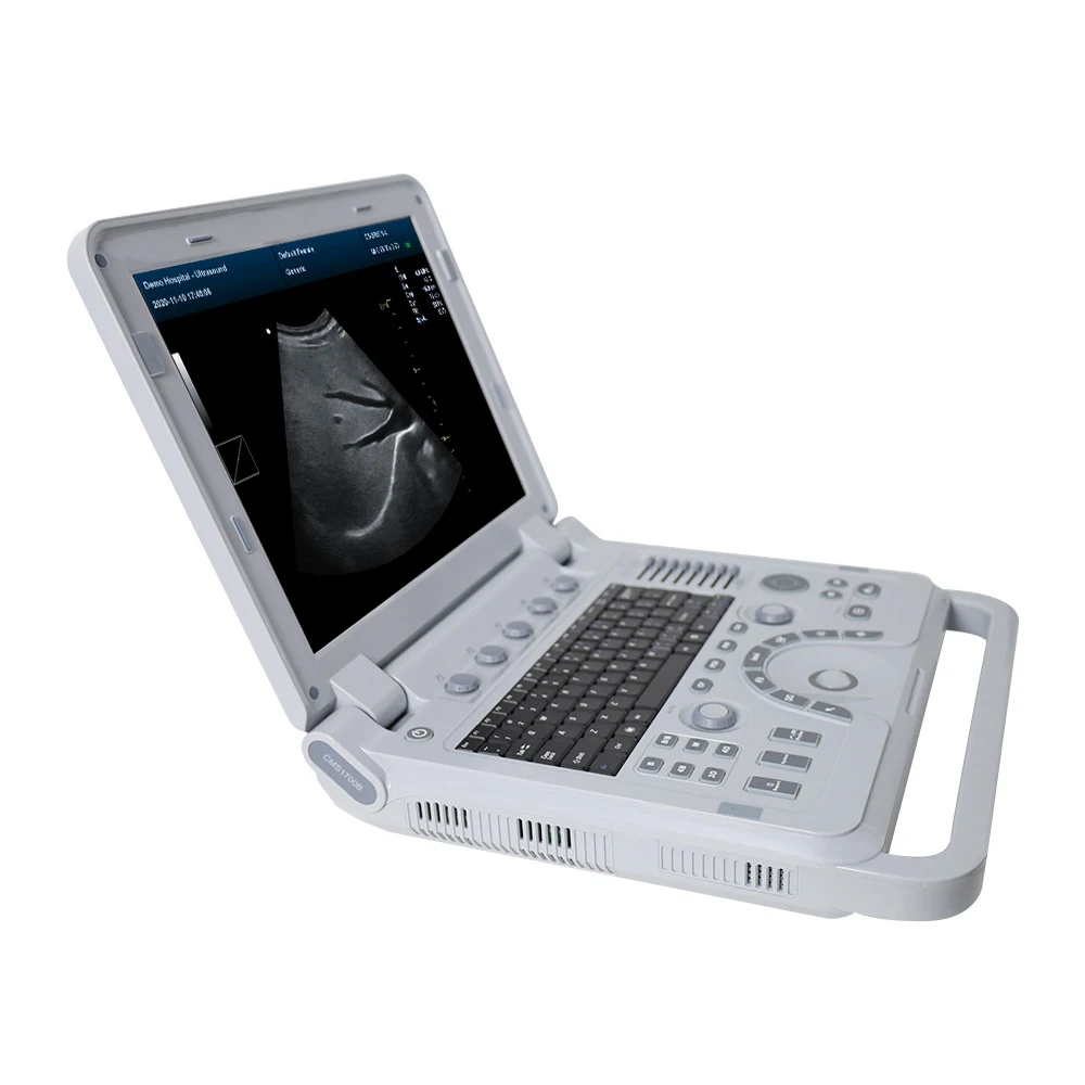 2025/CONTEC CMS1700B Ультразвуковой аппарат VET для ветеринарной клиники Ветеринарный ультразвуковой аппарат