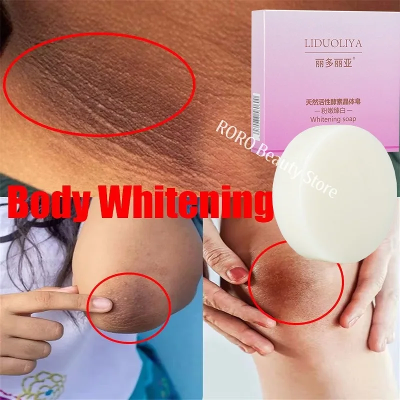 صابون تبييض الجسم تحت الإبط صابون تبييض الركبة إزالة جلد الدجاج إزالة البقع الداكنة الجلد الميت ترطيب سطع العناية بالجسم #1