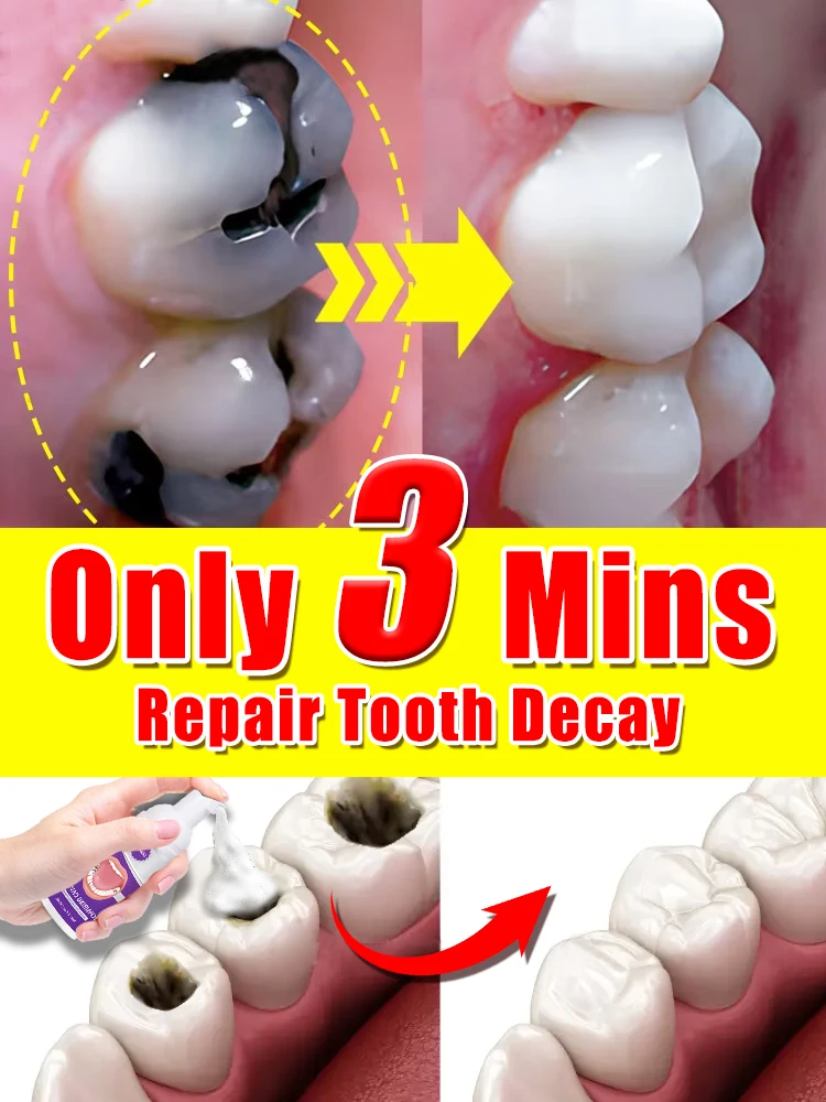 

tooth decay repair