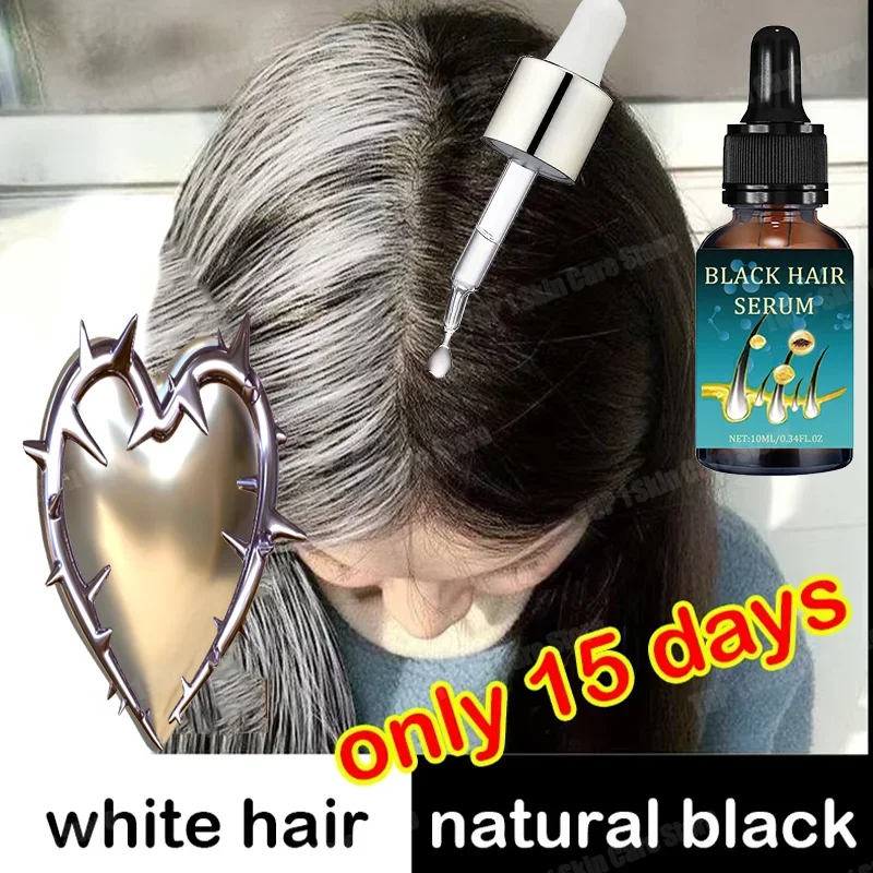 Natural and Healthy White To Black hair No hair color,no allergies Anti-grey quickly turns white hair into black