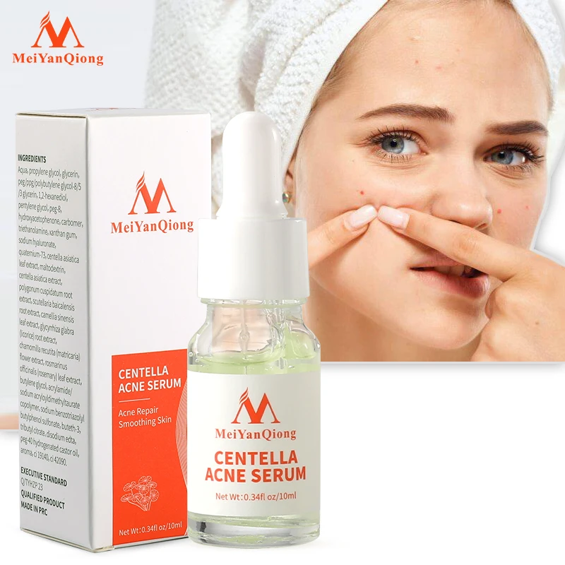 Centella Asiatica Acne Removing Essence Moisturizing Face Serum Shrink Pore Control Oil Liquid  Anti Wrinkle Whiten Skin Beauty