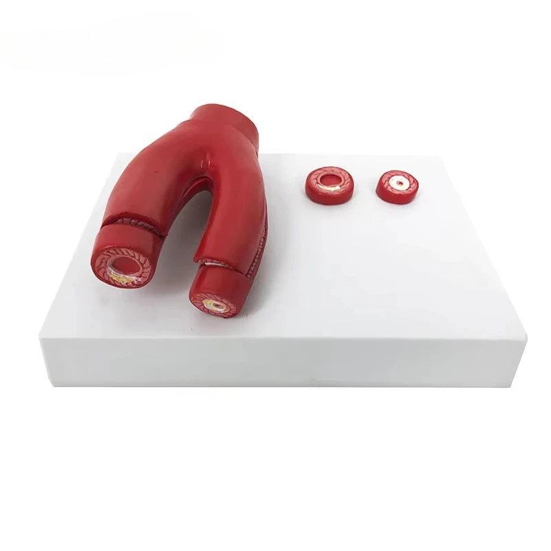 

School teaching anatomical model, vascular arteriosclerosis model