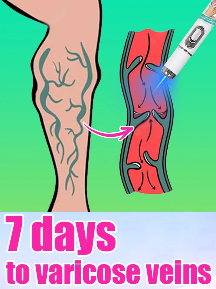 

Leg relief care blue light pen tool, dedicated red blood vessel expansion
