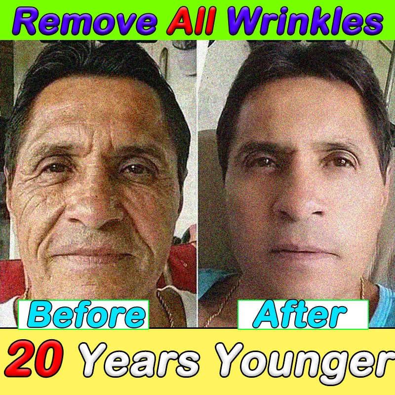 

OUHOE Anti-wrinkle Oxys Cream Wrinkle Face Cream Anti Aging Face Lift Facial Massagers Facial Lifting Beauty Health Skin Care