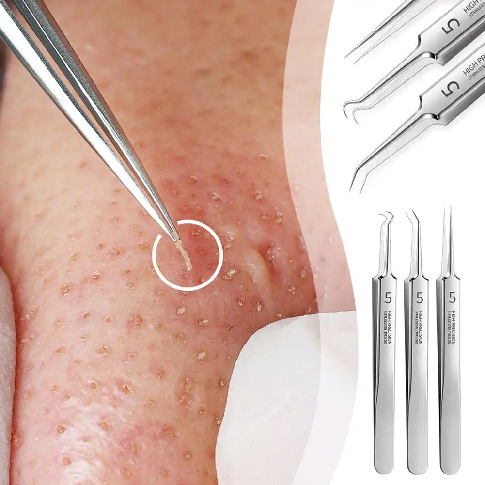 Немецкий Сверхтонкий зажим для удаления черных точек No.5, инструмент для очистки черных точек, игла, пинцет 0,1 m A6t8