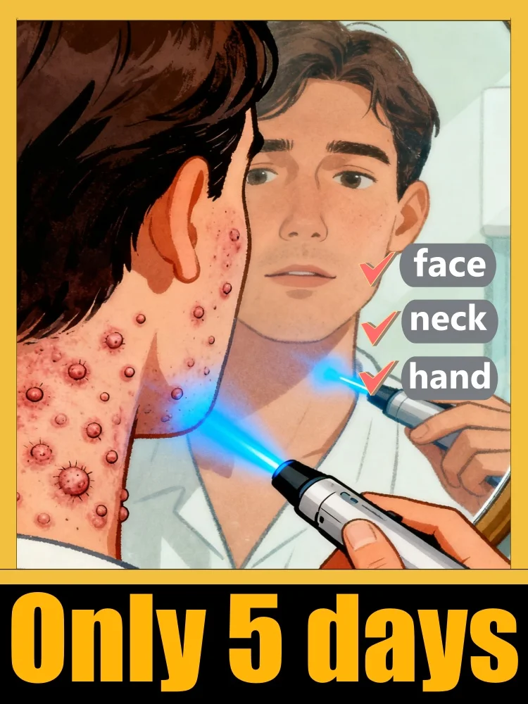 

2025 New Product: Wart Care Kit with Optimizing Pen - A Sustainable Skin Investment