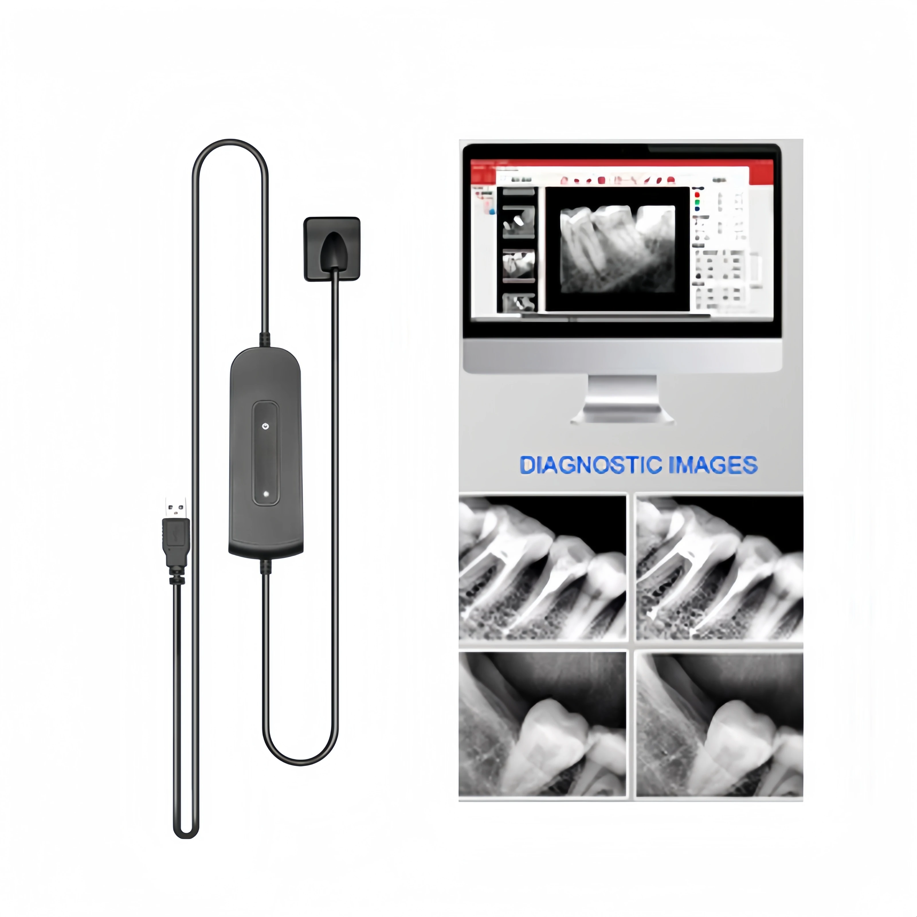 Dentistry Digital cameras Sensor X-Ray Dental High-Frequency Rx Digital Intraoral Digital System H D Image Radiovisografo Tools