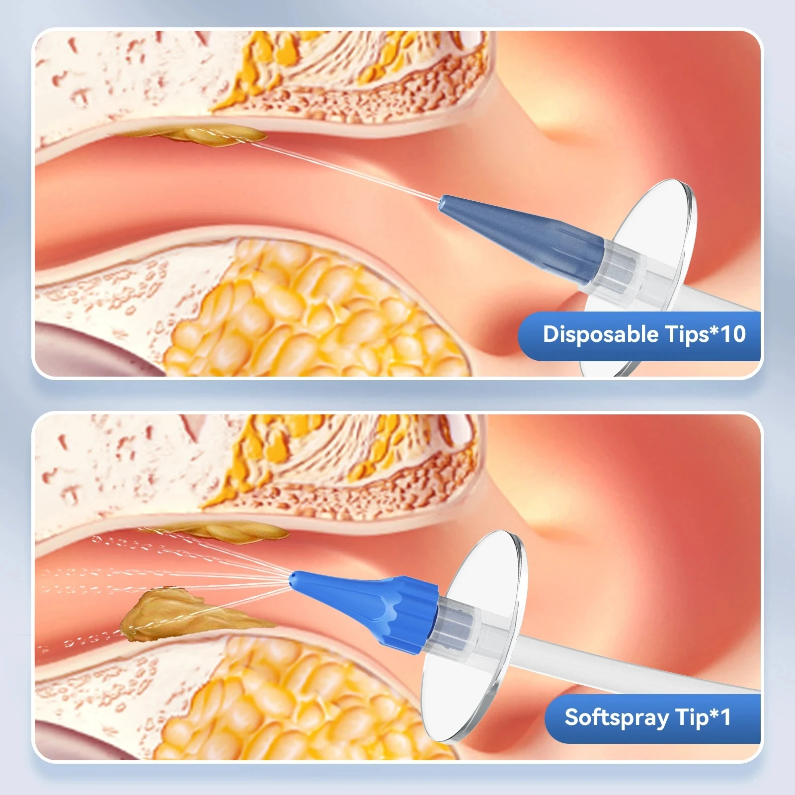 10個の交換用チップ付きクリーニングツール,耳掃除機,耳かき,洗浄,ワックス除去,消毒,クリーナー,ケア