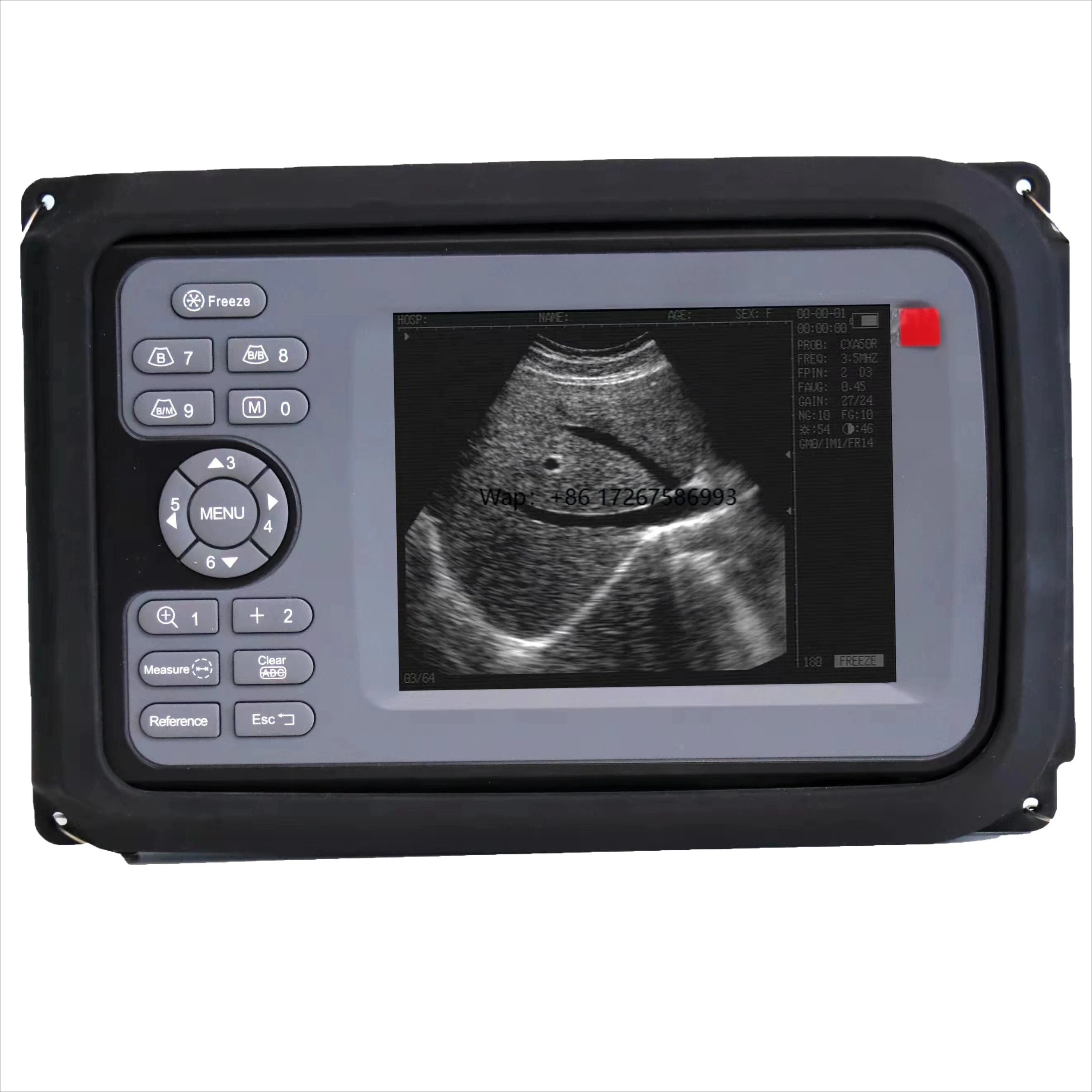Handscan Pig Cattle Cow Bovine Equine Veterinary Equipment for Large Animals Veterinary
