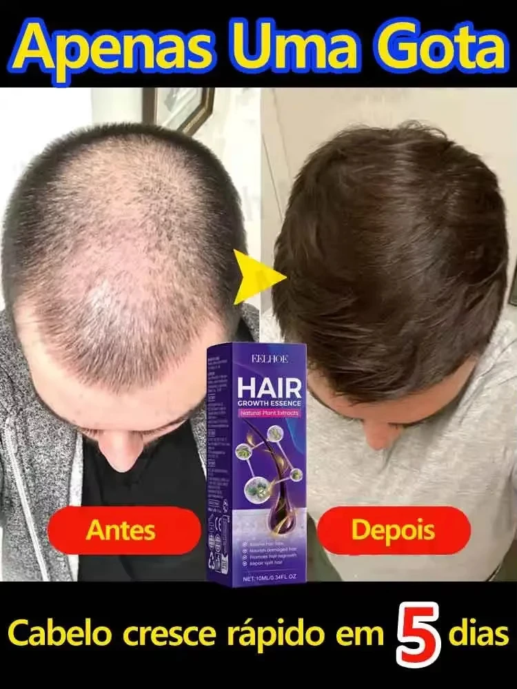 Hot sale, buyers will buy again, hair is getting more and more, say goodbye to baldness, sparse hair starts to become thick.