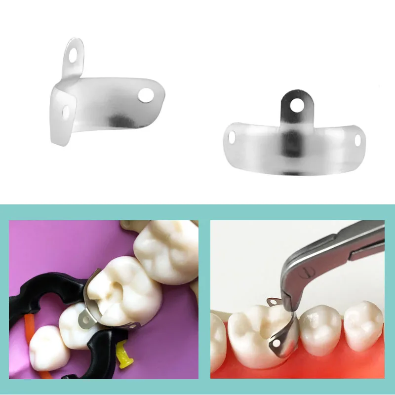 50/100 قطعة العصابات مصفوفة الأسنان الاقسام احيط المعادن المصفوفات العصابات مع ثقوب لاستبدال الأسنان مواد طب الأسنان أداة #4